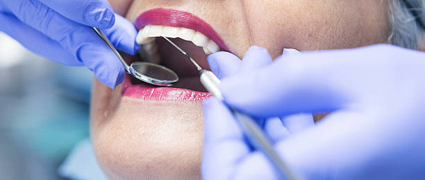 Best Emergency Tooth Extraction in Newton, AL